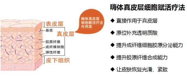 嗨體注射脖子除皺