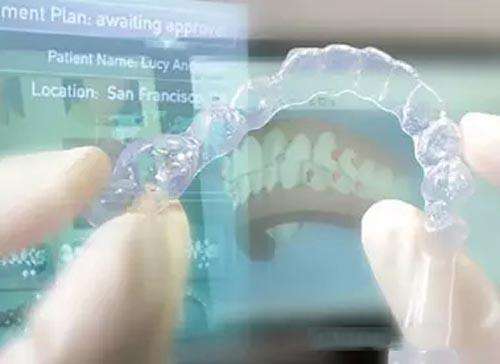 矯正牙齒的方式有幾種?