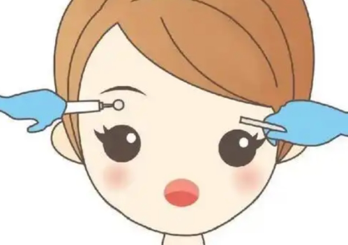 填眉弓用什么玻尿酸好？一篇說(shuō)清不同產(chǎn)品在支撐力與穩(wěn)定性上的真實(shí)表現(xiàn)